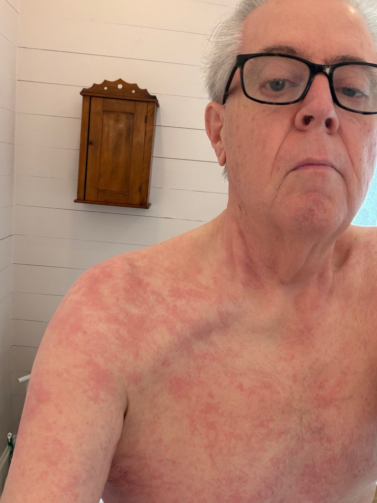 Skin changes before diagnosis, June 25, 2026