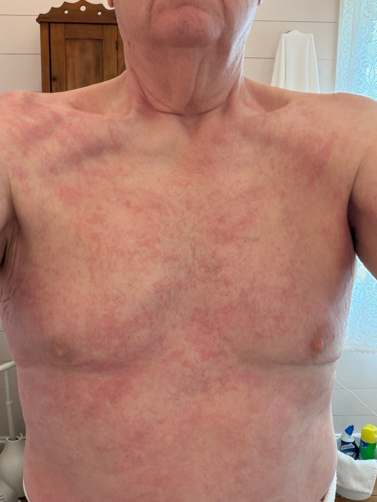 Skin changes before diagnosis, June 25, 2026